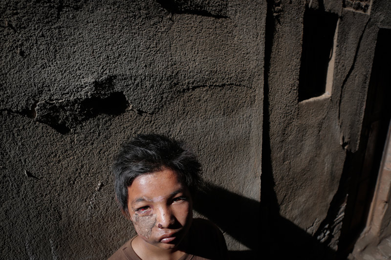 Photo d'un garçon blessé par un tremblement de terre au Népal