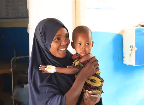 Malnourished child in Somalia 